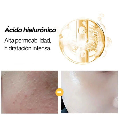 Serum Gold 24K -  Rejuvenecedor Acido Hialuronico y Ceramida